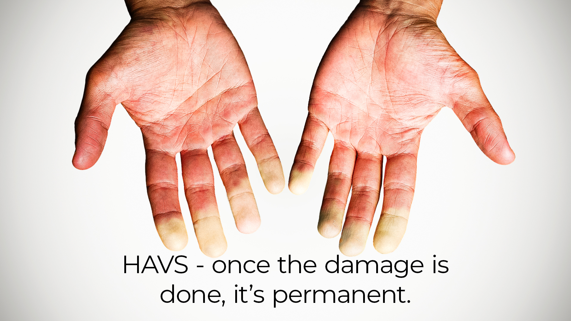 Understanding Hand Arm Vibration Syndrome HAVS Frequently Asked Understanding Hand Arm Vibration Syndrome HAVS Frequently Asked